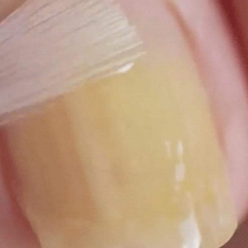Una solución suave y eficaz para la reparación de uñas naturales-ES